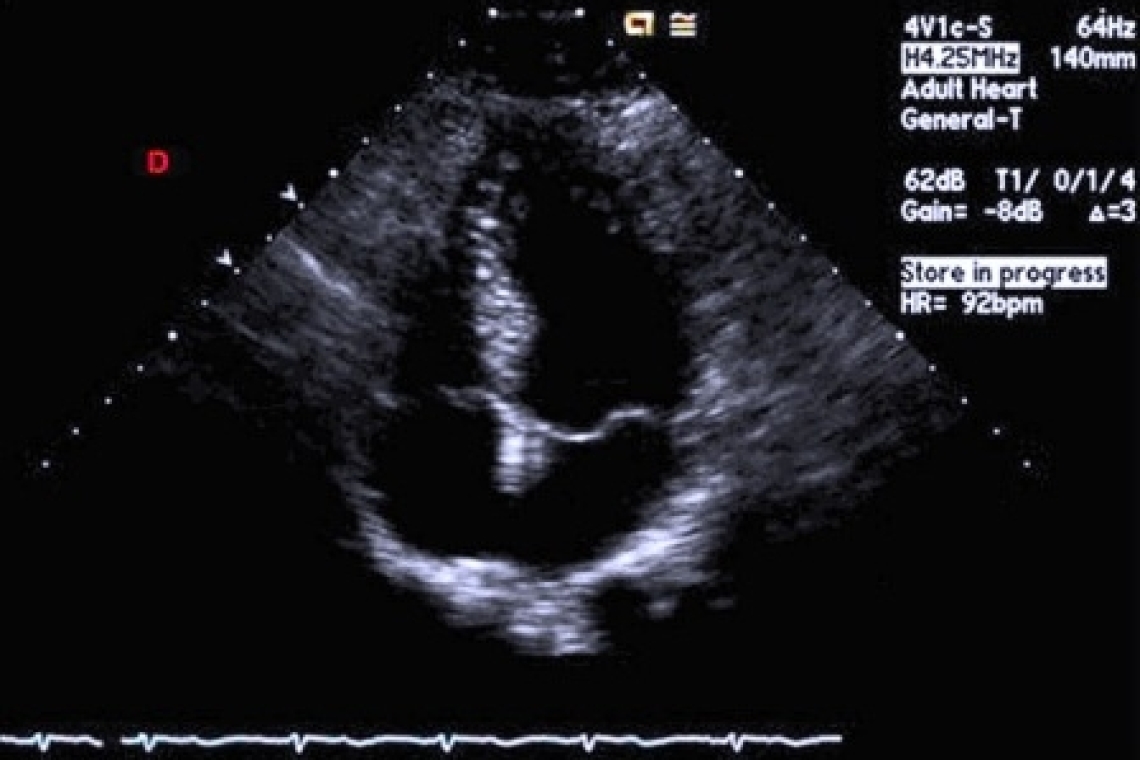 Оценка сердечно-сосудистой системы во время беременности