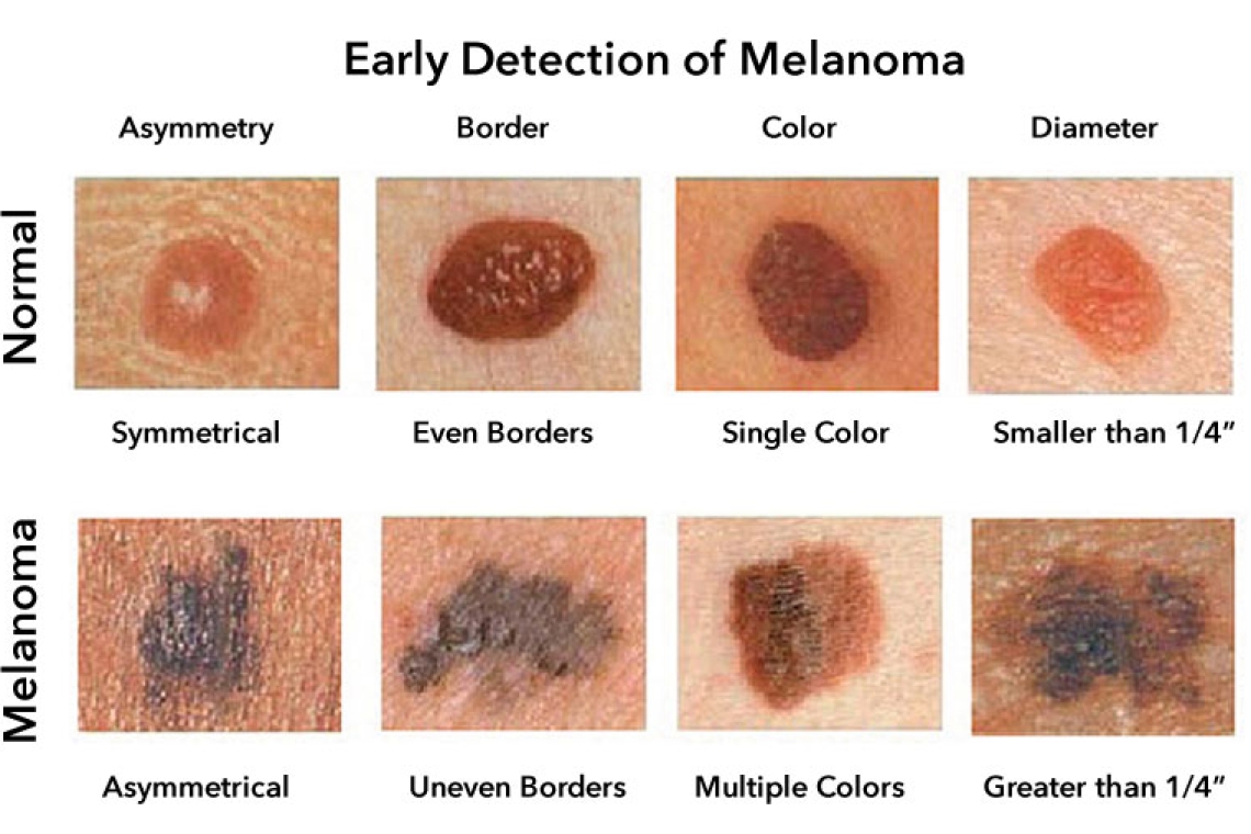 Болезни от больших денег